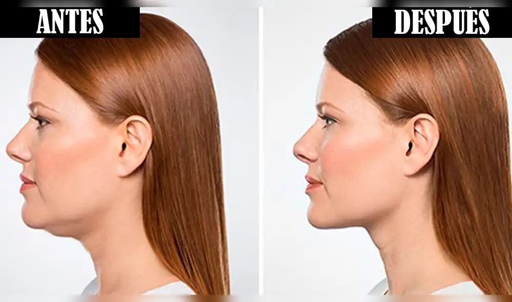 YouTube: elimina la papada en solo segundos con este sencillo paso [VIDEO] 