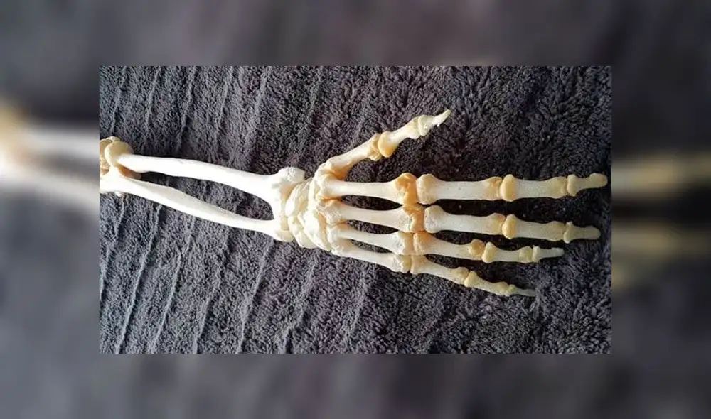Hombre conserva los huesos disecados del brazo que le amputaron [FOTOS]