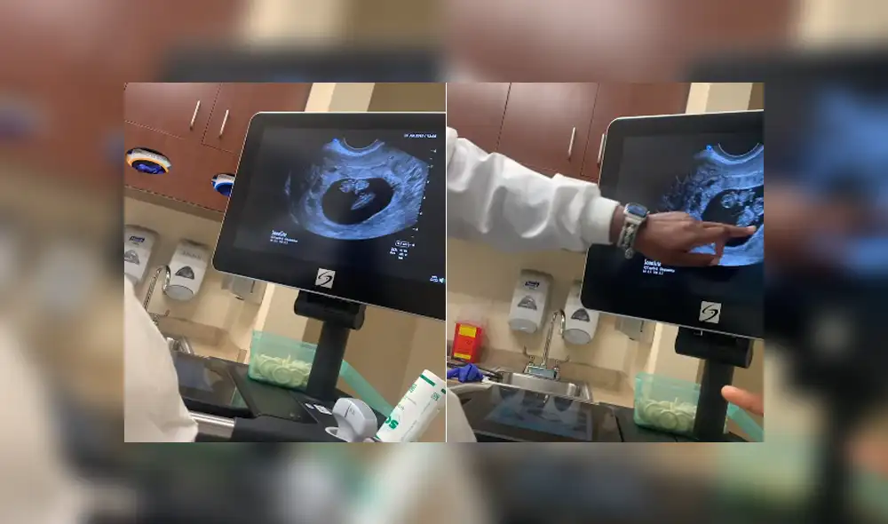 La mujer se emocionó luego de que le dijeran que iba a tener gemelos. Foto: YouTube La mujer se emocionó luego de que le dijeran que iba a tener gemelos. Foto: YouTube