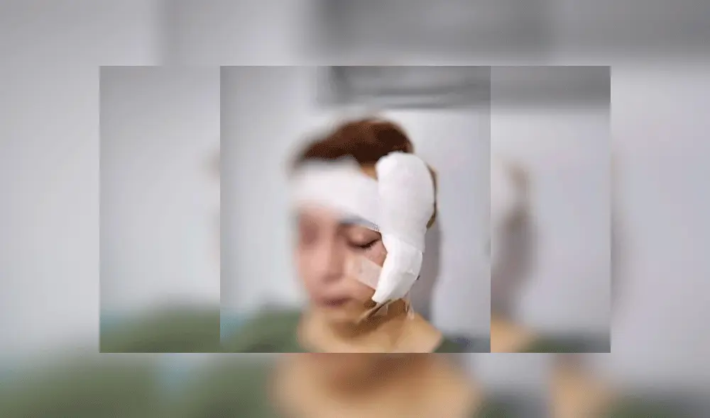 Jorge Acosta quedó con fracturas y fisuras tras el incidente. Foto: Nuevo Día. Jorge Acosta quedó con fracturas y fisuras tras el incidente. Foto: Nuevo Día.