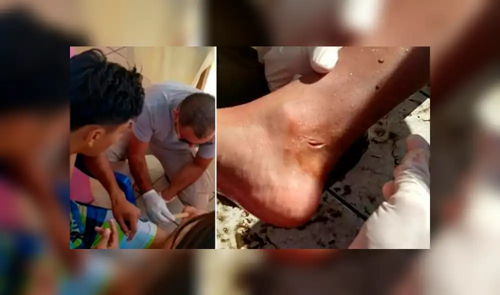 Serpientes marinas atacan a decena de turistas en playa de México Serpientes marinas atacan a decena de turistas en playa de México