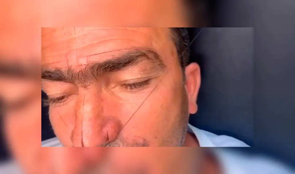 Facebook viral: hombre con las cejas ‘pobladas’ se somete a drástico cambio de ‘look’ y resultado cautiva a miles