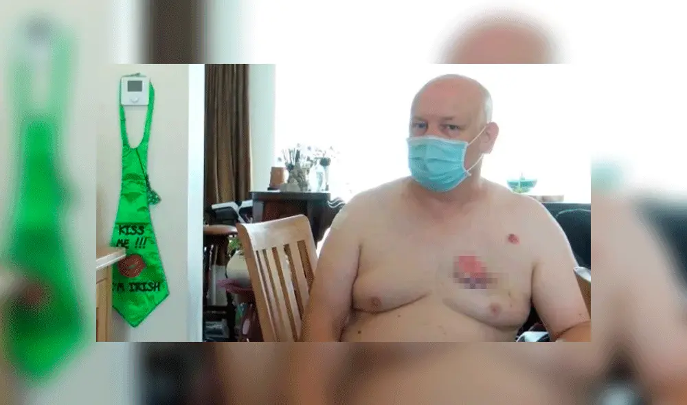 Robert Murphy, natural de Irlanda, mostró una herida en el pecho como prueba de la agresión. Foto: CEN. Robert Murphy, natural de Irlanda, mostró una herida en el pecho como prueba de la agresión. Foto: CEN.