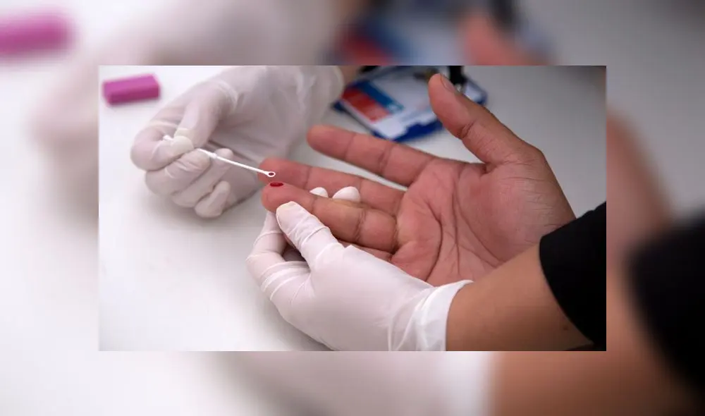 Prueba de VIH. Foto: AFP