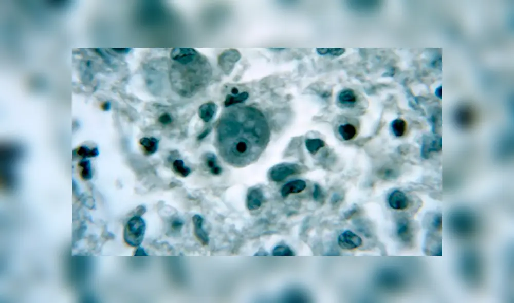 Ameba 'come cerebros': ¿Qué es, cuáles son los síntomas y cómo se contagia?