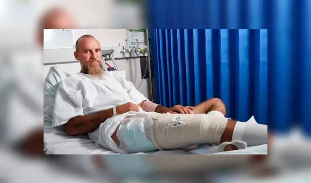 Búfalo hirió de gravedad la pierna de su cazador antes de morir. Foto: NT News