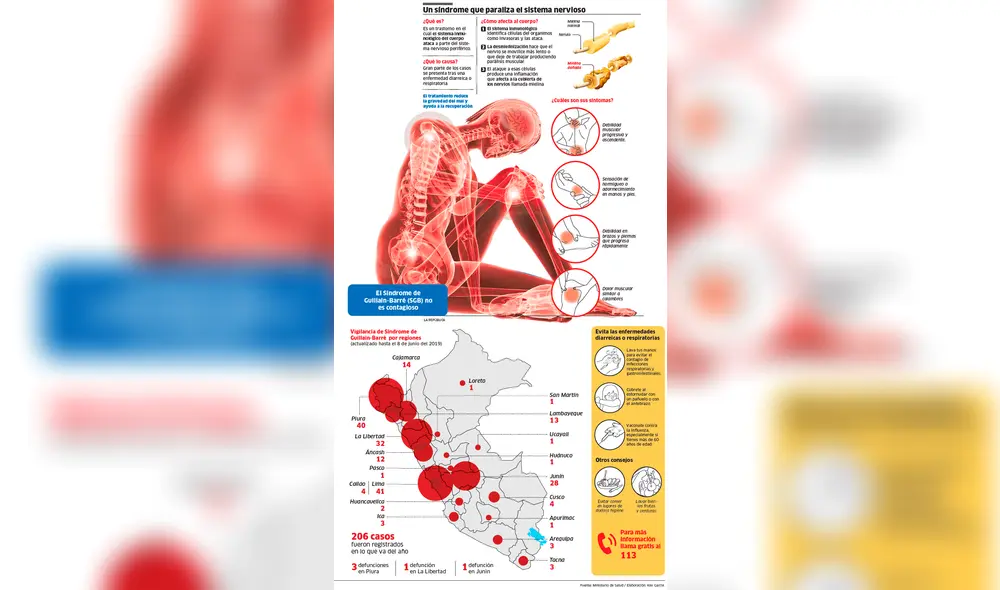 Síndrome Guillain-Barré: Un mal que paraliza el sistema nervioso [INFOGRAFÍA]