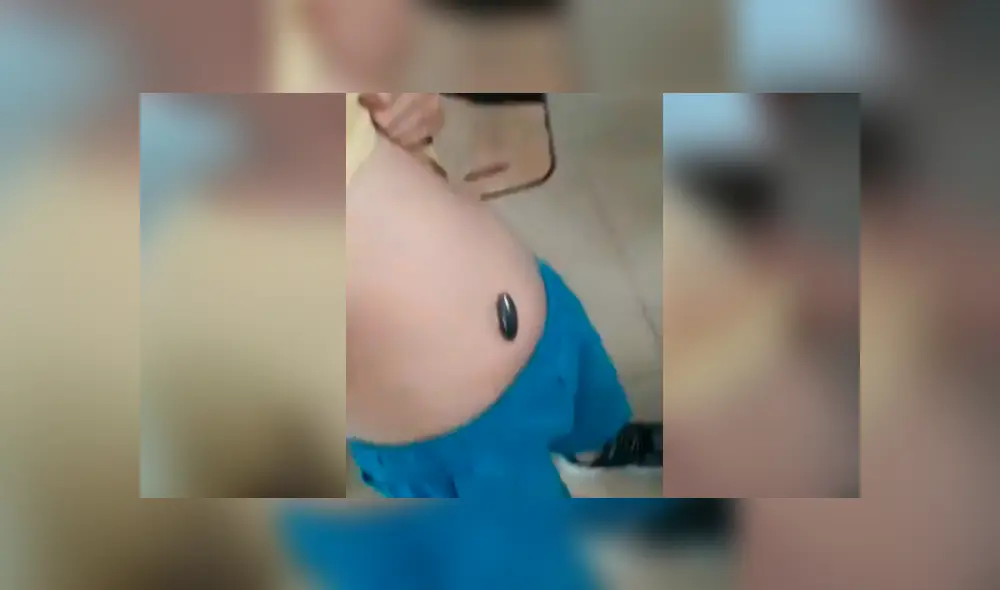 Facebook viral: niño se traga imán y sus padres hacen algo increíble para intentar ayudarlo