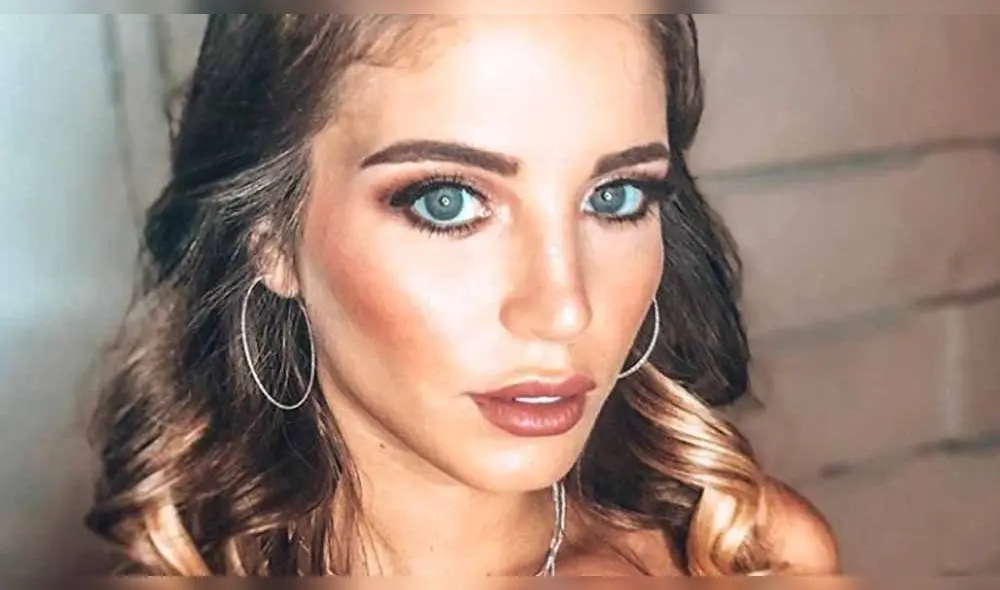 Flavia Laos sufre duras críticas por culpa de un mala cirugía plástica