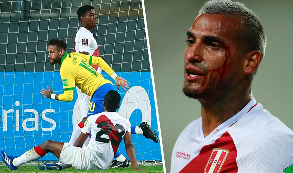 Miguel Trauco recibió un duro golpe en la ceja en el Perú vs. Brasil. Fotos: AFP Miguel Trauco recibió un duro golpe en la ceja en el Perú vs. Brasil. Fotos: AFP