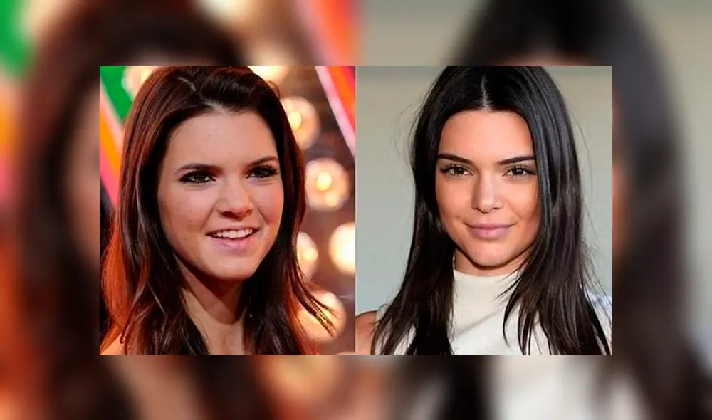 Kendall Jenner, antes y después de cirugías. Kendall Jenner, antes y después de cirugías.