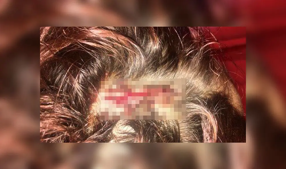 Detienen a hombre que atacó a joven con un hacha: estaba “harto” del Día de la Mujer Detienen a hombre que atacó a joven con un hacha: estaba “harto” del Día de la Mujer