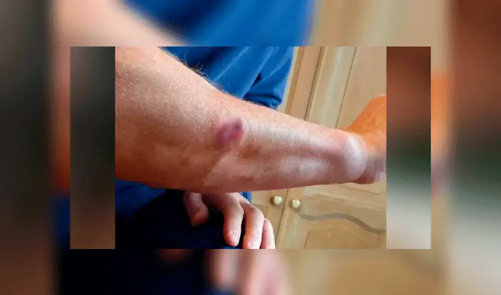 Su dueño también fue atacado por los canes, dejándole una profunda herida en el brazo (Captura: The Sun)