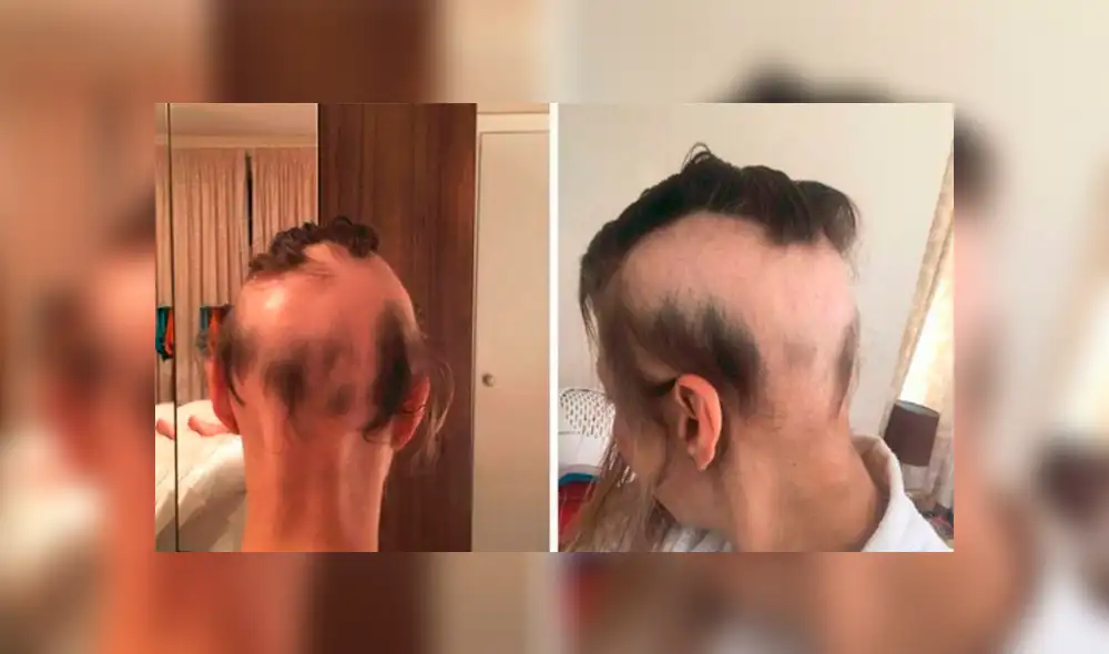 Facebook viral: novia pierde el 90 % de su cabello por el estrés de su boda y así termina [FOTOS] 