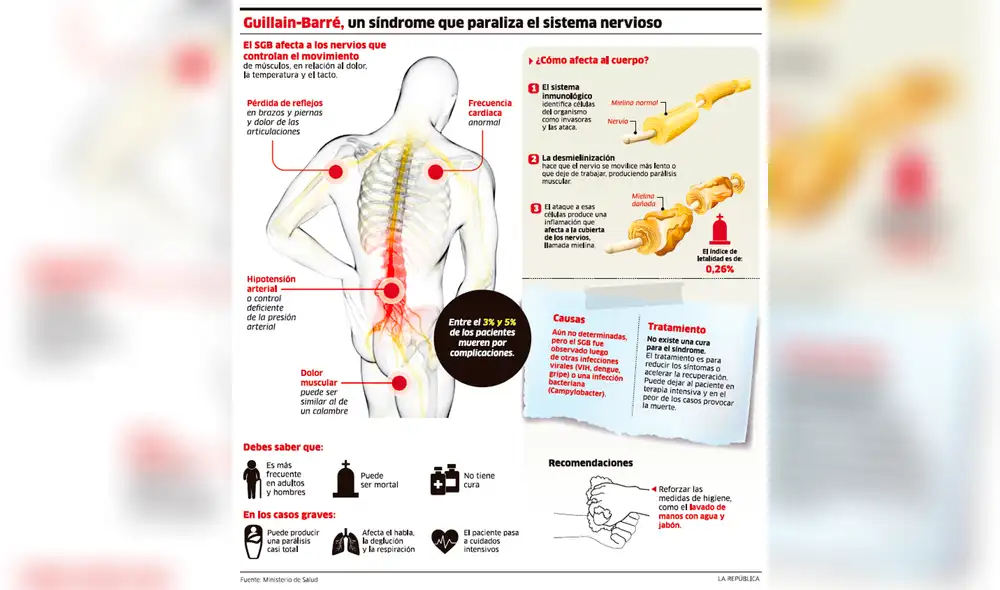 Guillian-Barré, un síndrome que paraliza el sistema nervioso