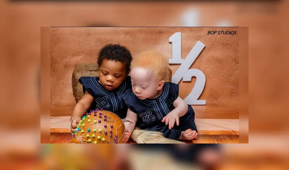 Bebés mellizos con diferente color de piel y cabello sorprenden al mundo [FOTOS]