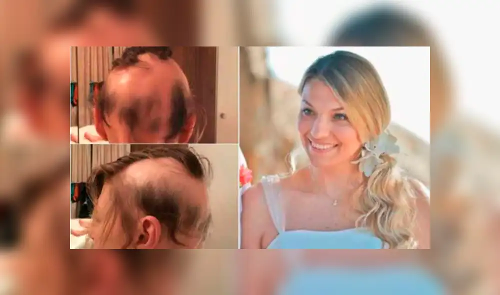 Facebook viral: novia pierde el 90 % de su cabello por el estrés de su boda y así termina [FOTOS] 