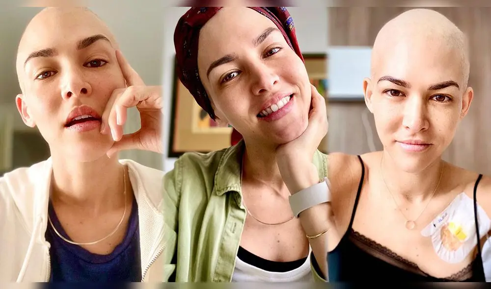 Anahí de Cárdenas reveló terrible experiencia tras quimioterapia. Foto: Composición