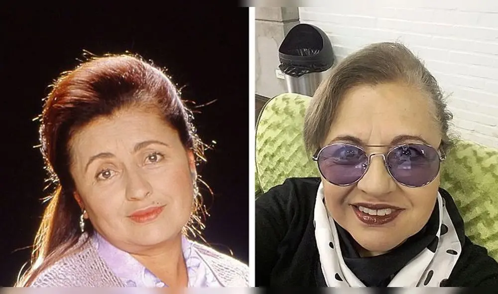 Betty la fea antes y después