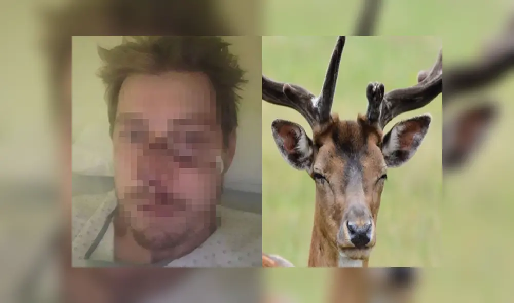 Cazador quedó con el rostro desfigurado. Foto: El Clarín