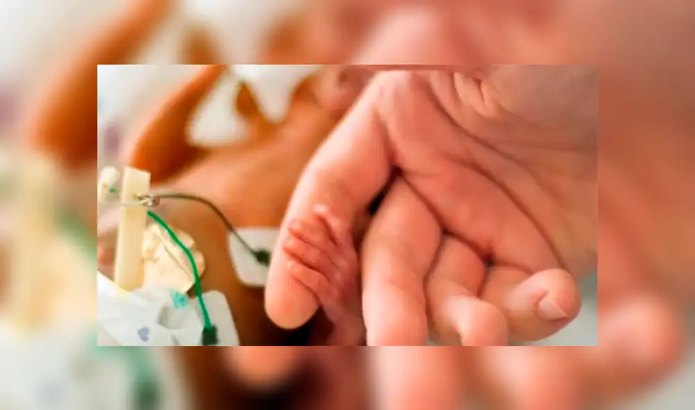 Publican la primera foto de bebé “sin rostro”.