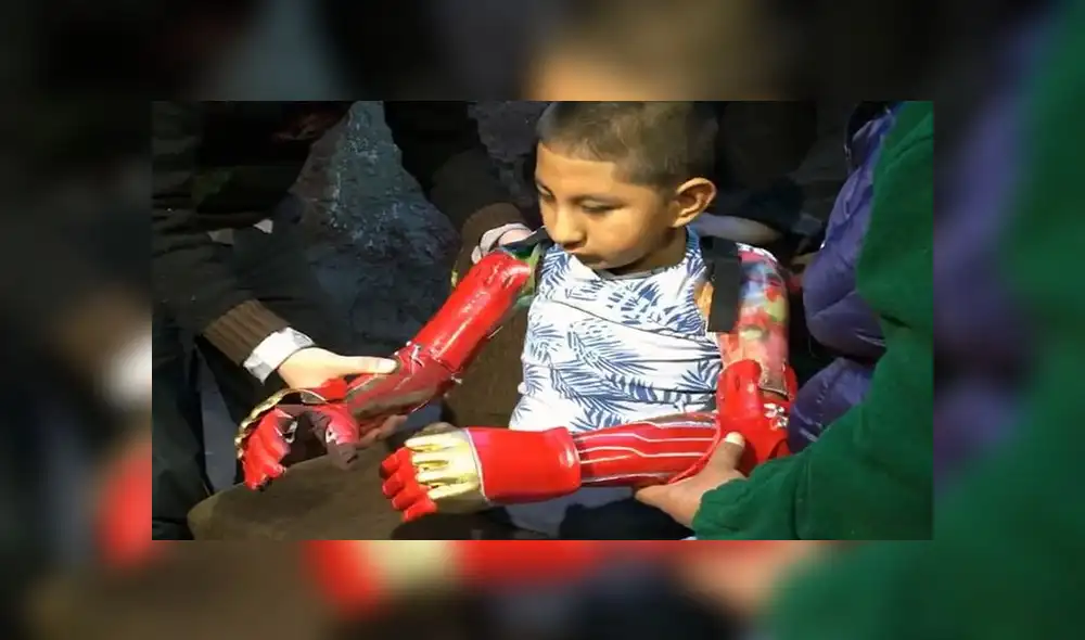 Niño cusqueño recibió prótesis de brazos elaboradas con impresión 3D Niño cusqueño recibió prótesis de brazos elaboradas con impresión 3D