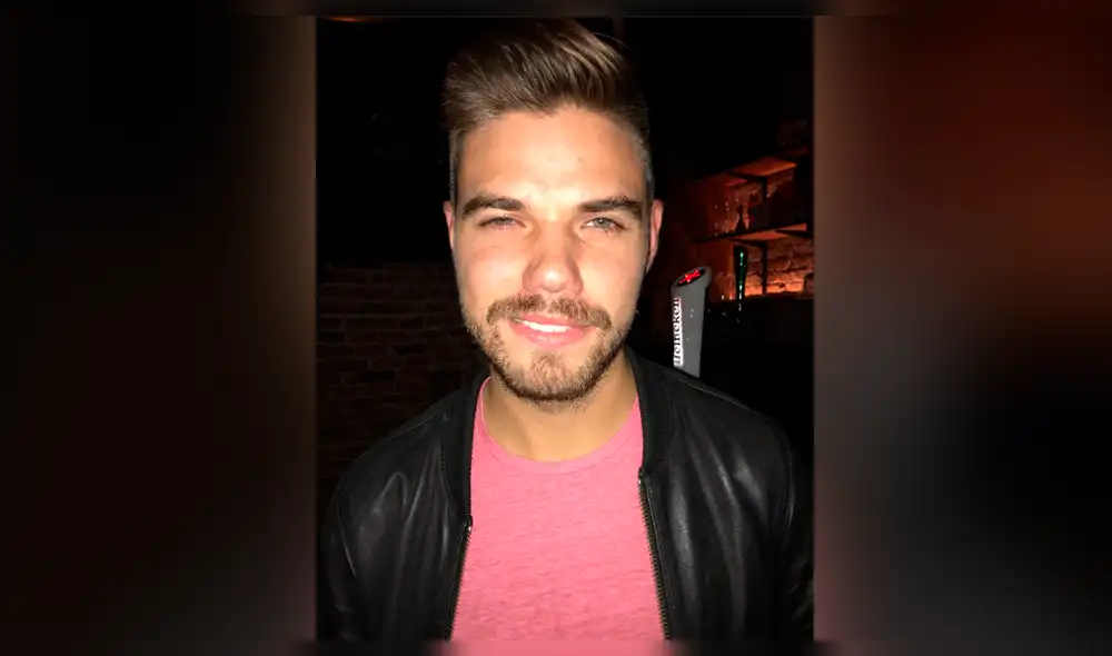 Alergia le cambia la apariencia por completo al teñirse el cabello