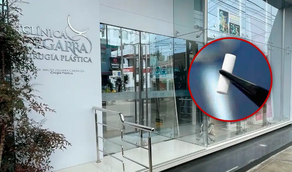 Paciente llegó a la clínica para elevar su nivel de testosterona. Foto: composición LR/ difusión