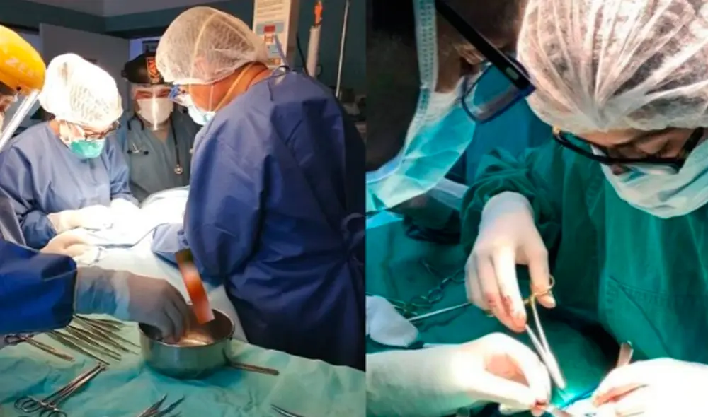 Se realizó en el Hospital Víctor Ramos Guardia. (Foto: Pablo Trujillo). Se realizó en el Hospital Víctor Ramos Guardia. (Foto: Pablo Trujillo).