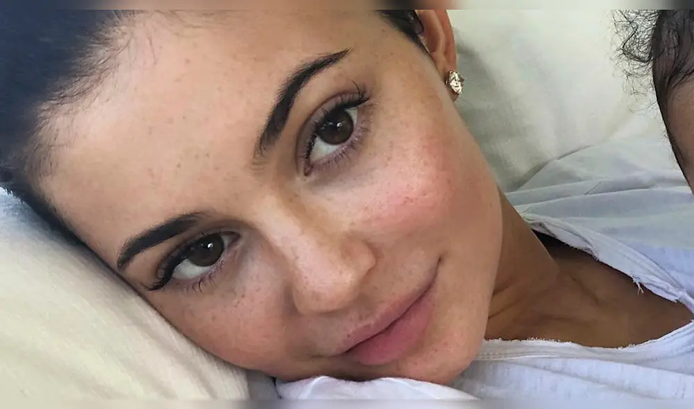 Kylie Jenner se quita el maquillaje y los filtros para presumir sus pecas en Instagram