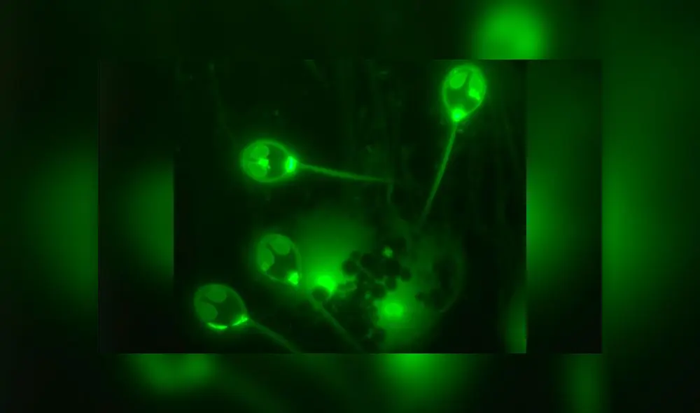 El Henneguya salminicola es un animal parásito del salmón. Imagen: Stephen Douglas Atkinson. El Henneguya salminicola es un animal parásito del salmón. Imagen: Stephen Douglas Atkinson.