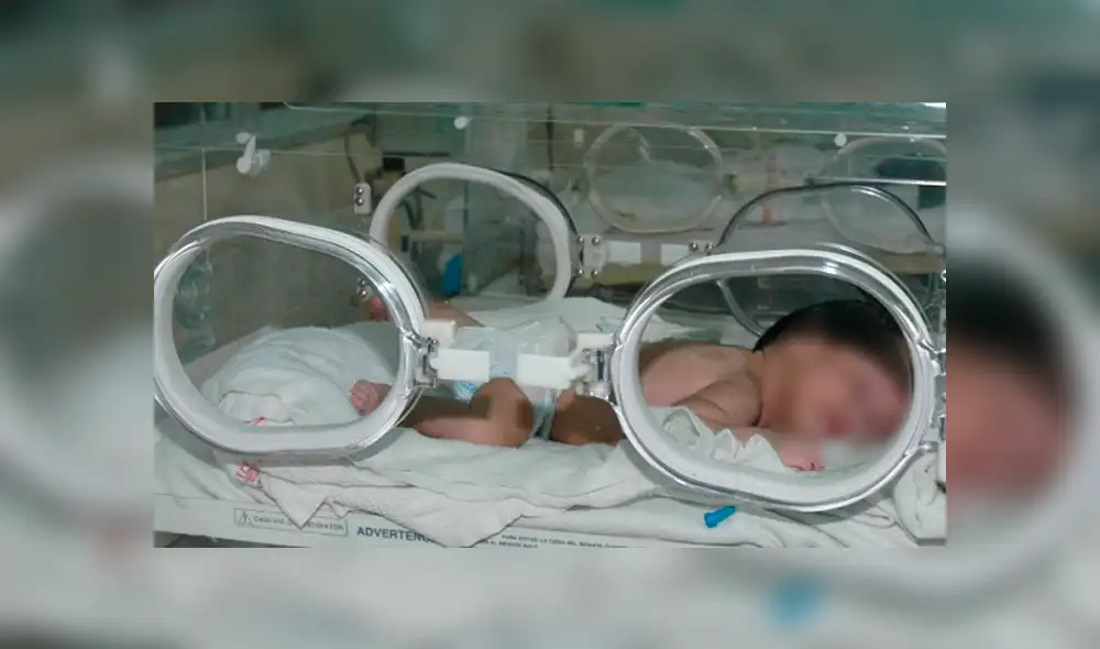 Bebé abandonado en San Juan de Miraflores evoluciona favorablemente