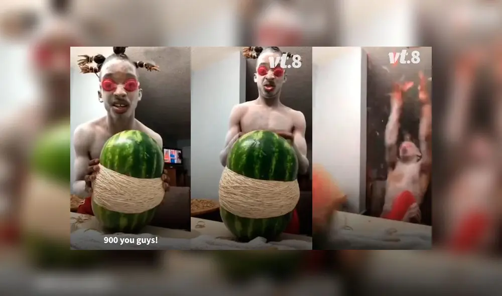 Desliza las imágenes para ver el terrible resultado que obtuvo un joven al hacer un experimento casero. Foto: VT Desliza las imágenes para ver el terrible resultado que obtuvo un joven al hacer un experimento casero. Foto: VT