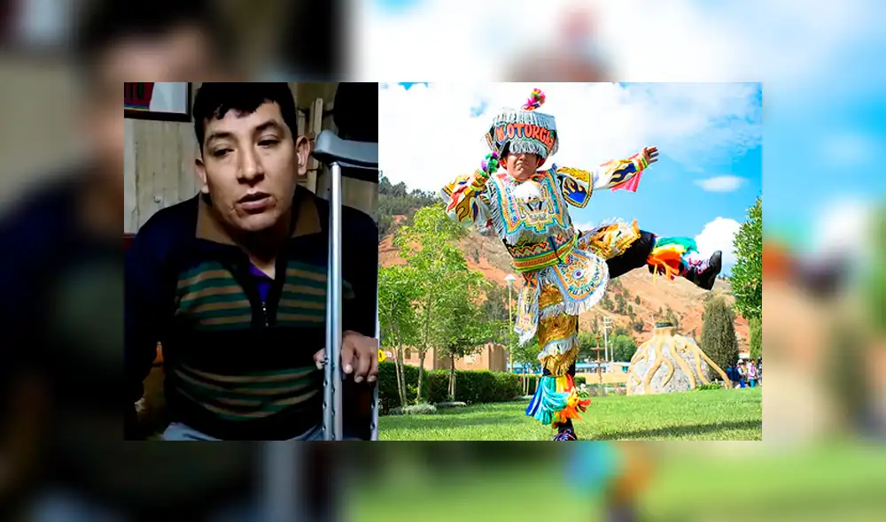 Danzante de tijeras solicita apoyo para solventar gastos de cirugía. Foto: Captura de video Danzante de tijeras solicita apoyo para solventar gastos de cirugía. Foto: Captura de video