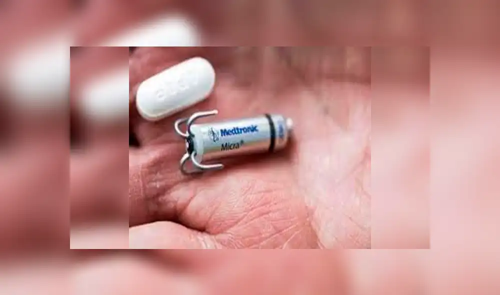 Implantan con éxito el marcapasos más pequeño del mundo a hombre de 74 años