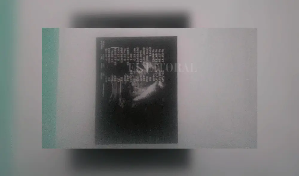 Mujer da a luz a un bebé con dos cabezas y los doctores no se dieron cuenta Mujer da a luz a un bebé con dos cabezas y los doctores no se dieron cuenta