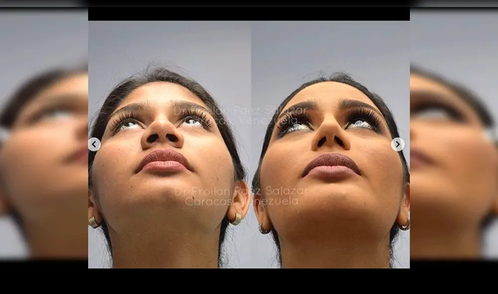 Filtran inéditas imágenes de Miss Venezuela antes de operaciones en el rostro