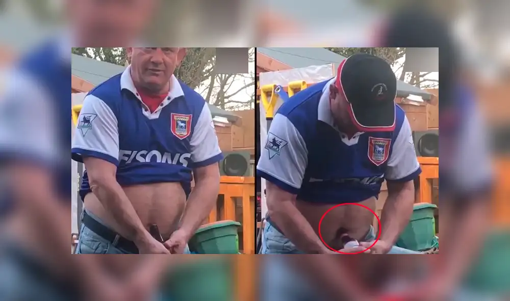 Facebook viral: hombre intenta abrir una cerveza con su ombligo y el desenlace es asqueroso [VIDEO] 