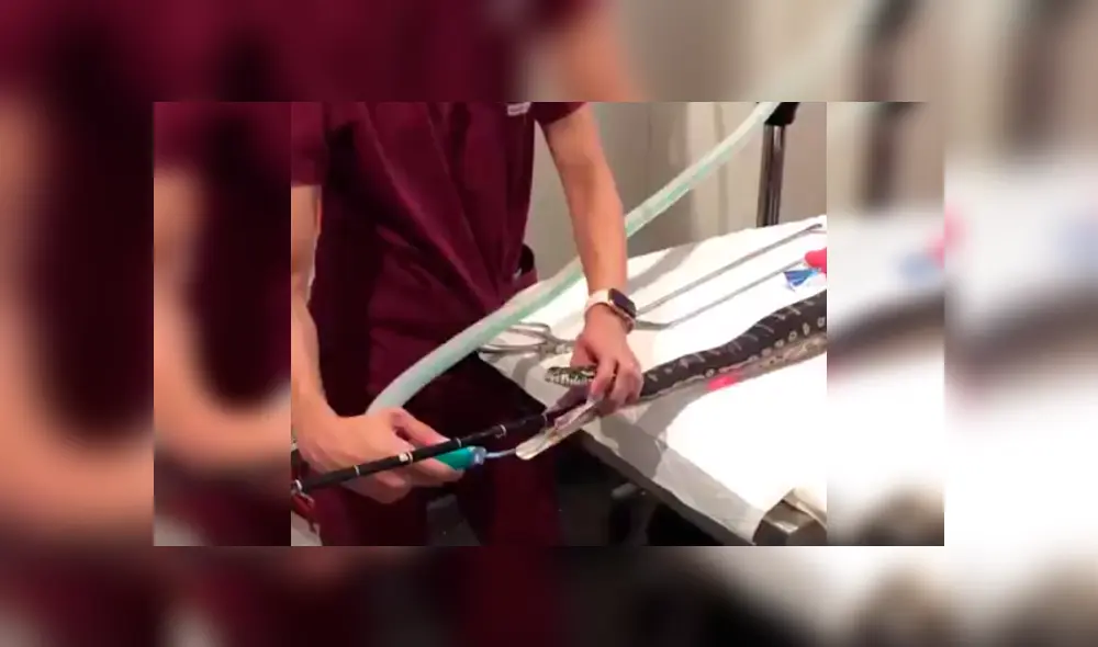 Desliza las imágenes para observar la valiente acción de un grupo de veterinarios para sacar una toalla del estómago de una pitón.