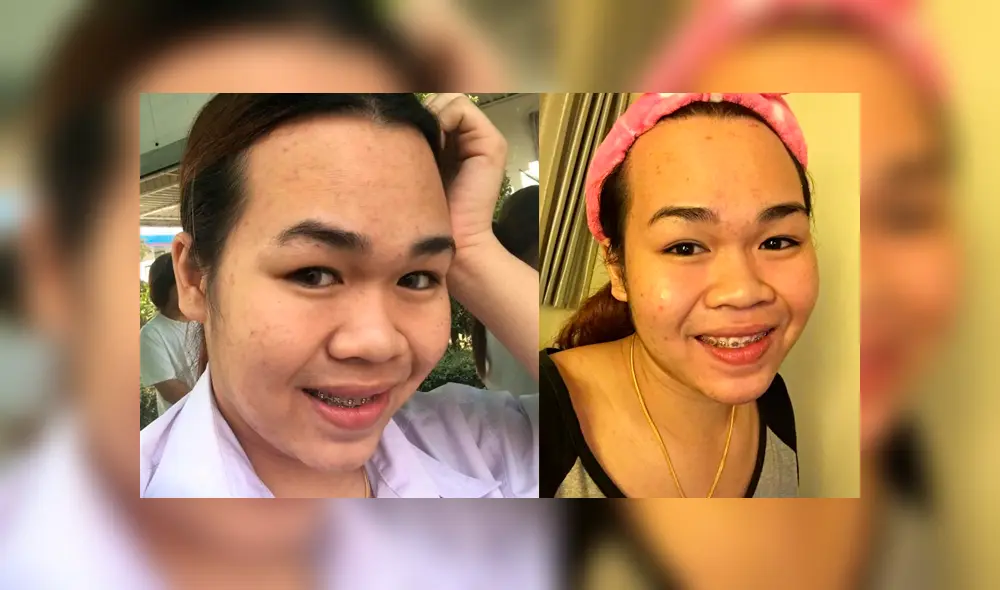 Vía Facebook: asiática se harta de ser el 'patito feo' y cambia su aspecto con rigurosas cirugías [FOTOS]