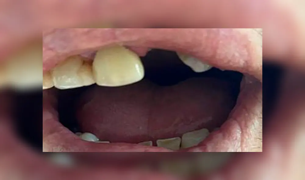 Muerde en la oreja a Rottweiler que atacaba a sus mascotas y pierde un diente