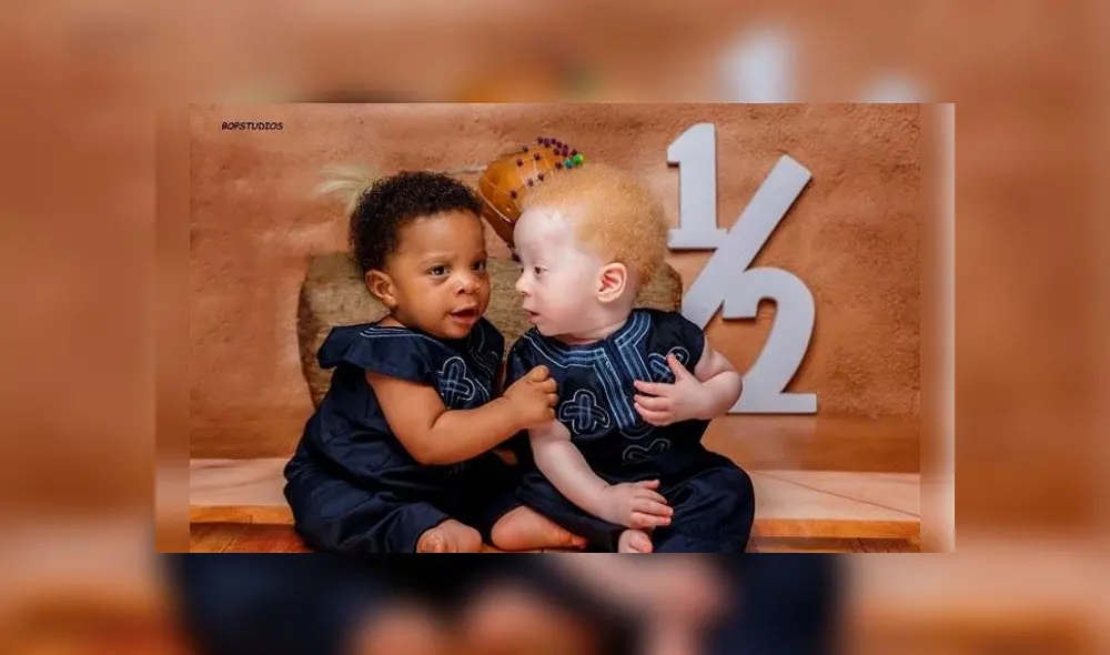 Bebés mellizos con diferente color de piel y cabello sorprenden al mundo [FOTOS]