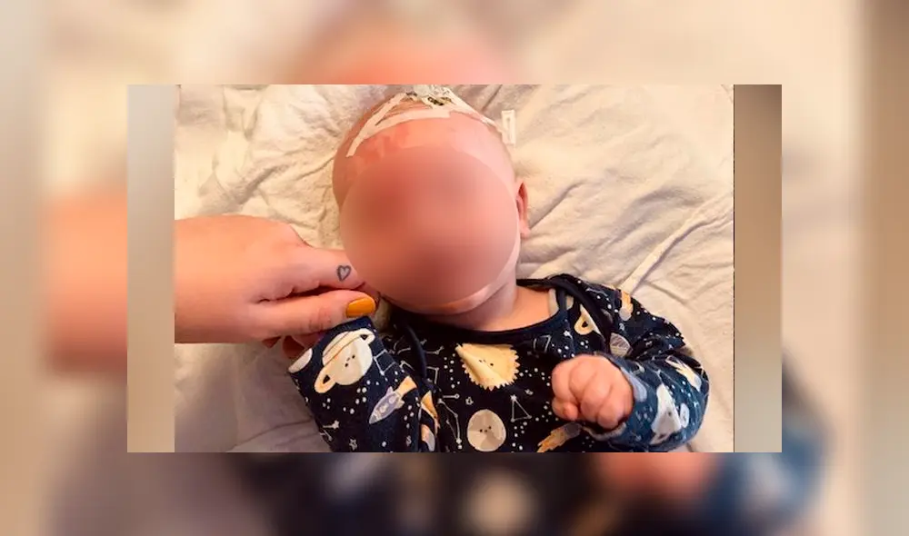 Oscar ha sufrido de 10 convulsiones en solo una semana tras la detección del síndrome (Captura: The Mirror) Oscar ha sufrido de 10 convulsiones en solo una semana tras la detección del síndrome (Captura: The Mirror)