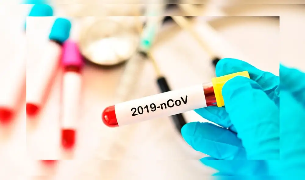 Aumentan casos de COVID-19 en Cajamarca Aumentan casos de COVID-19 en Cajamarca