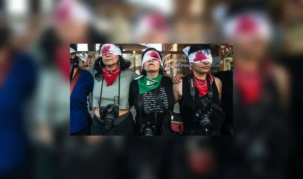 Víctimas de trauma ocular exigen a gobierno de Piñera una reparación efectiva Víctimas de trauma ocular exigen a gobierno de Piñera una reparación efectiva