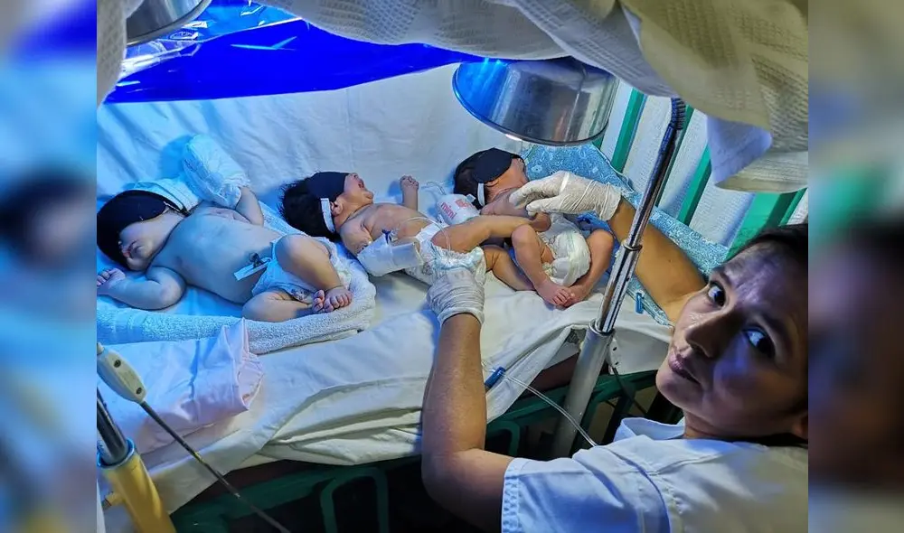 Viven. Los bebés prematuros son salvados al mantener su calor corporal en tinas convertidas en "incubadoras".