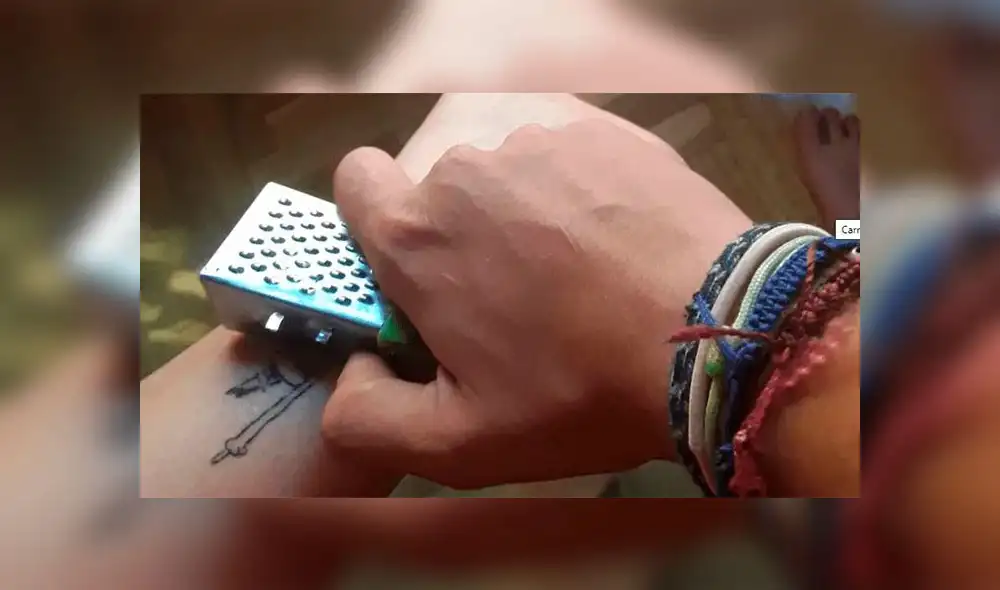 Chico que usó rallador de queso para borrar su tatuaje: “Me dolió y sangró muchísimo” [VIDEO]