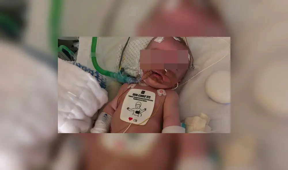 Michael fue equipado con un marcapasos después de despertarse del coma. Foto: Difusión. Michael fue equipado con un marcapasos después de despertarse del coma. Foto: Difusión.