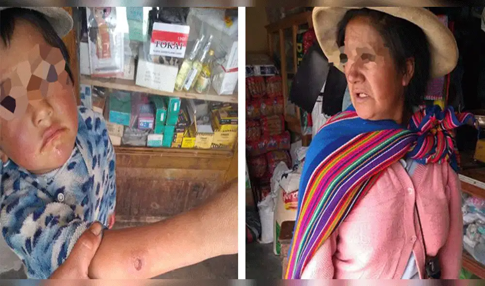 Personas infectadas por la Uta. Personas infectadas por la Uta.