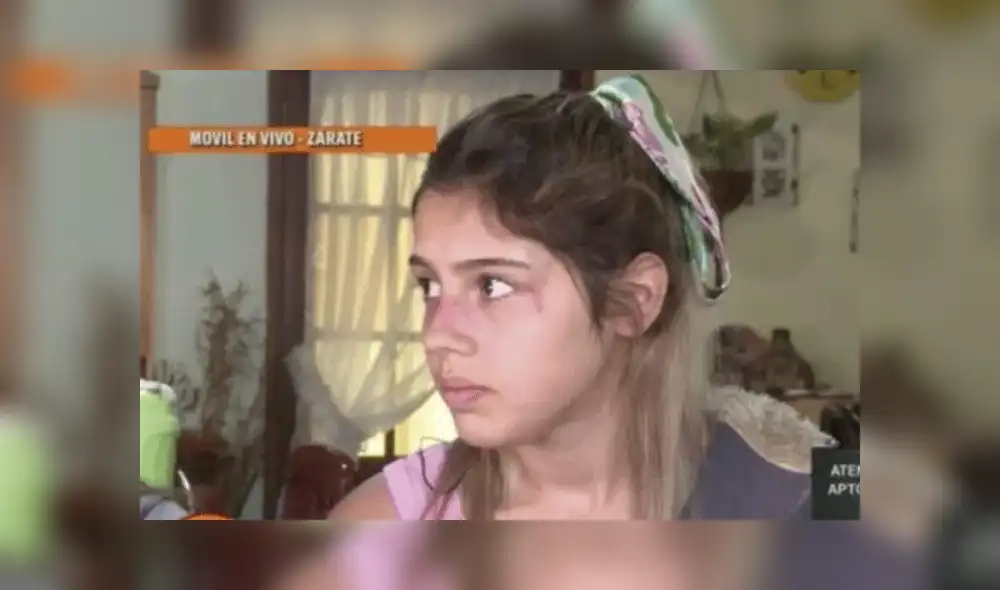 La víctima no sufrió lesiones graves.